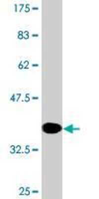 Western Blot: RBP2 Antibody (3G12) [H00005948-M02]