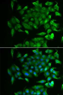 Immunocytochemistry/ Immunofluorescence: RBP2 Antibody - BSA Free [NBP2-94108]