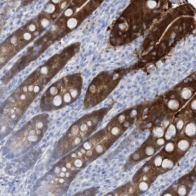 Immunohistochemistry-Paraffin: RBP2 Antibody [NBP1-85464]
