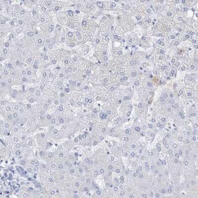 Immunohistochemistry-Paraffin: RBP2 Antibody [NBP1-85464]
