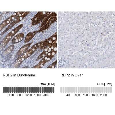 Immunohistochemistry-Paraffin: RBP2 Antibody [NBP1-85464]