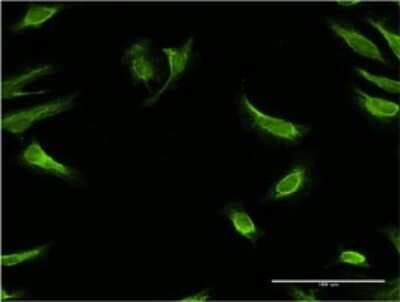 Immunocytochemistry/ Immunofluorescence: RBP7 Antibody (4F4) [H00116362-M01]