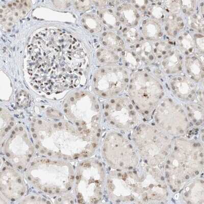 Immunohistochemistry-Paraffin: RBP7 Antibody [NBP1-84383]