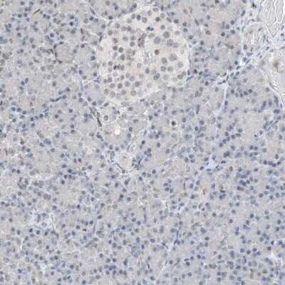 Immunohistochemistry-Paraffin: RBP7 Antibody [NBP1-84383]