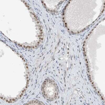 Immunohistochemistry-Paraffin: RBP7 Antibody [NBP1-84383]