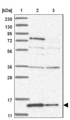 Western Blot: RBP7 Antibody [NBP1-84383]