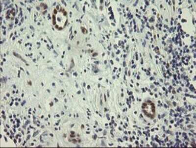 Immunohistochemistry: RBPMS Antibody (OTI2G10) [NBP2-45551]