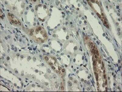 Immunohistochemistry: RBPMS Antibody (OTI2G10) [NBP2-45551]