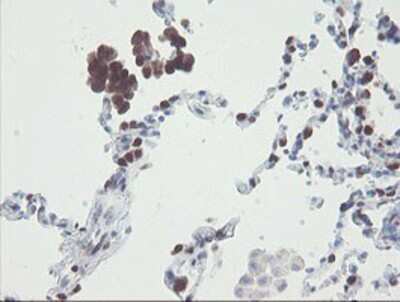 Immunohistochemistry-Paraffin: RBPMS Antibody (OTI3B7) [NBP2-03905]