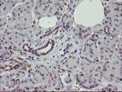 Immunohistochemistry-Paraffin: RBPMS Antibody (OTI3B7) [NBP2-03905]