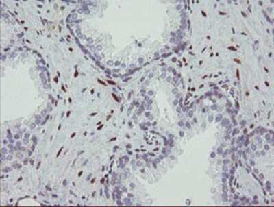 Immunohistochemistry-Paraffin: RBPMS Antibody (OTI3B7) [NBP2-03905]
