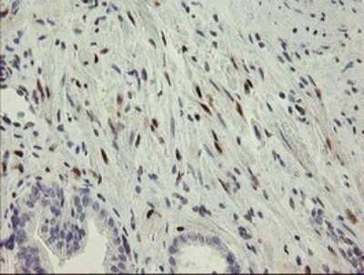 Immunohistochemistry: RBPMS Antibody (OTI2G10) - Azide and BSA Free [NBP2-73835]
