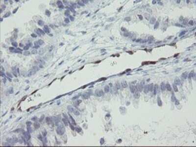 Immunohistochemistry: RBPMS Antibody (OTI3B7) - Azide and BSA Free [NBP2-73836]