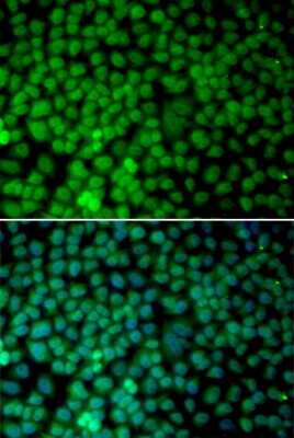 Immunocytochemistry/ Immunofluorescence: RBX1 Antibody - BSA Free [NBP2-93616]