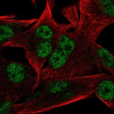 Immunocytochemistry/ Immunofluorescence: RC74 Antibody [NBP2-57534]