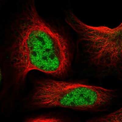 Immunocytochemistry/ Immunofluorescence: RC74 Antibody [NBP2-58713]