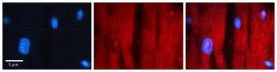 Immunohistochemistry-Paraffin: RCAN1 Antibody [NBP2-86771]