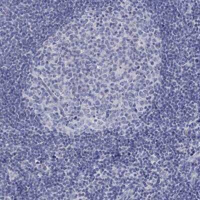 Immunohistochemistry-Paraffin: RCAN1 Antibody [NBP3-16971]