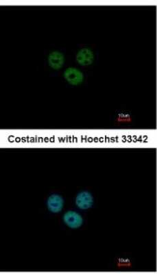 Immunocytochemistry/ Immunofluorescence: RCBTB1 Antibody [NBP2-20116]