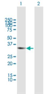 Western Blot: RCBTB1 Antibody [H00055213-B01P]