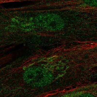 Immunocytochemistry/ Immunofluorescence: RCBTB2 Antibody [NBP1-85636]