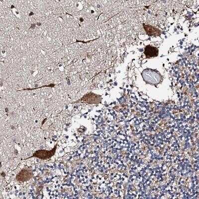 Immunohistochemistry-Paraffin: RCBTB2 Antibody [NBP1-85636]