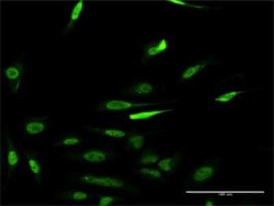 Immunocytochemistry/ Immunofluorescence: RCC1 Antibody (1C1) [H00001104-M02]