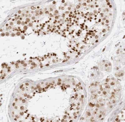 Immunohistochemistry-Paraffin: RCC1 Antibody [NBP1-85637]