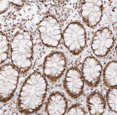Immunohistochemistry-Paraffin: RCC1 Antibody [NBP1-85637]