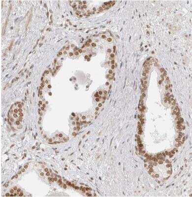 Immunohistochemistry-Paraffin: RCC1 Antibody [NBP1-85637]