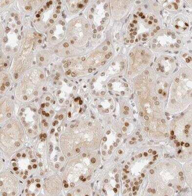 Immunohistochemistry-Paraffin: RCC1 Antibody [NBP1-85637]