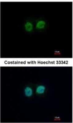 Immunocytochemistry/ Immunofluorescence: RCC2 Antibody [NBP2-20118]