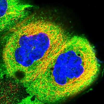 Immunocytochemistry/ Immunofluorescence: RCCD1 Antibody [NBP1-93517]