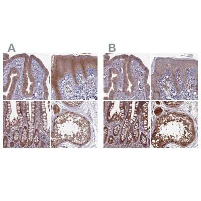 Immunohistochemistry-Paraffin: RCCD1 Antibody [NBP1-93517]
