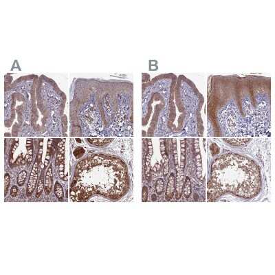 Immunohistochemistry-Paraffin: RCCD1 Antibody [NBP1-93518]