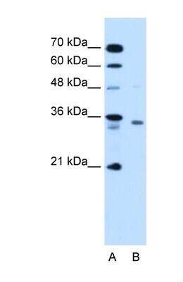 Western Blot: RCE1 Antibody [NBP1-59922]