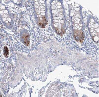 Immunohistochemistry-Paraffin: RCN1 Antibody [NBP1-83483]