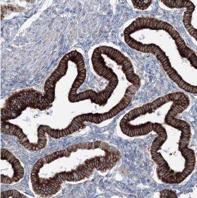 Immunohistochemistry-Paraffin: RCN1 Antibody [NBP1-83483]