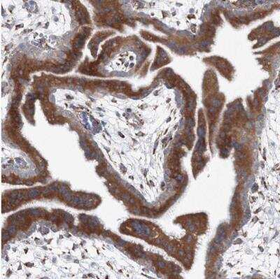Immunohistochemistry-Paraffin: RCN1 Antibody [NBP1-83483]