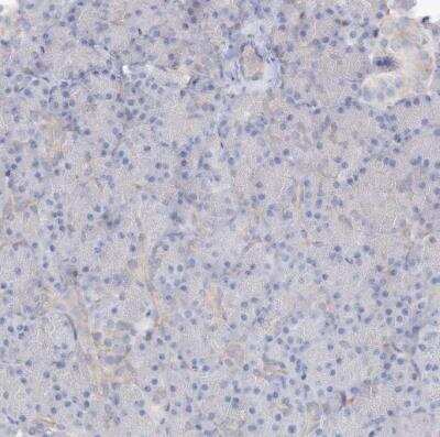 Immunohistochemistry-Paraffin: RCN1 Antibody [NBP1-83483]