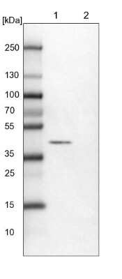 Western Blot: RCN1 Antibody [NBP1-83483]