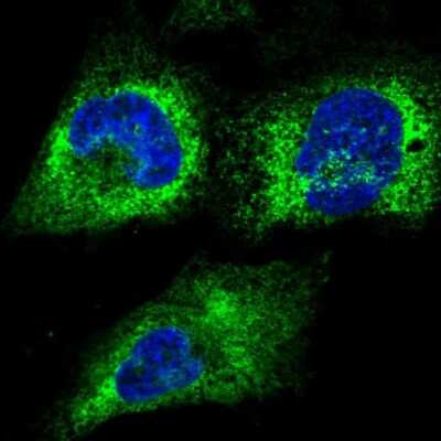 Immunocytochemistry/ Immunofluorescence: RCN2 Antibody [NBP2-32010]