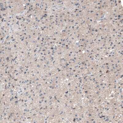 Immunohistochemistry-Paraffin: RCOR2 Antibody [NBP1-92323]