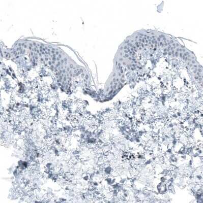 Immunohistochemistry-Paraffin: RCOR2 Antibody [NBP1-92323]