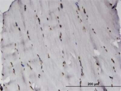 Immunohistochemistry-Paraffin: RCSD 1 Antibody (3F6) [H00092241-M01]