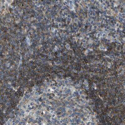 Immunohistochemistry-Paraffin: RCSD 1 Antibody [NBP2-13214]