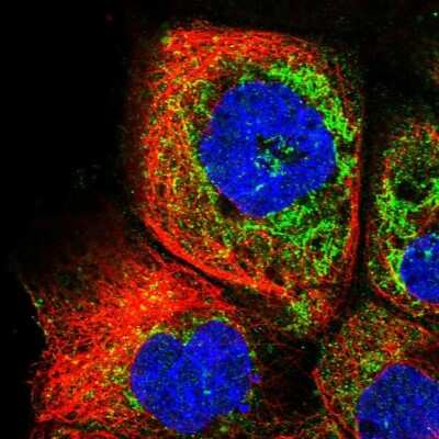 Immunocytochemistry/ Immunofluorescence: RDH13 Antibody [NBP1-92324]