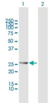 Western Blot: RDH13 Antibody [H00112724-B01P]