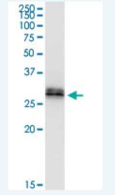 Western Blot: RDH16 Antibody [H00008608-B01P-50ug]