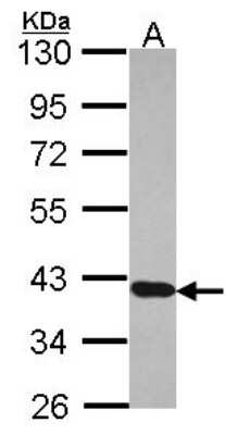 Western Blot: RDH5 Antibody [NBP2-15097]